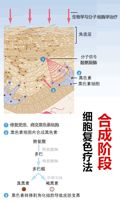 “细胞复色”疗法的治疗原理