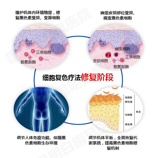 “细胞复色”疗法的治疗原理