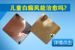 儿童白癜风能治愈吗?