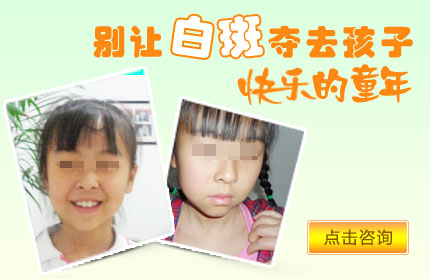 儿童患上白癜风会产生哪些心理问题?