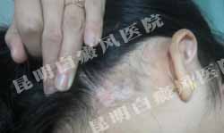 女大学生重拾昔日笑容