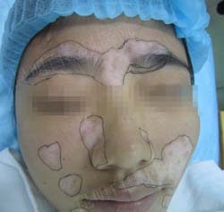 青春无限 美丽重现