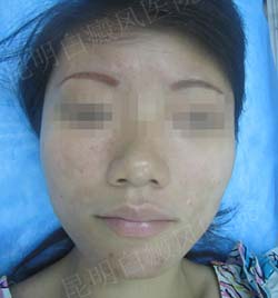 青春无限 美丽重现